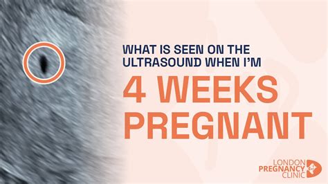 4 weeks pregnant