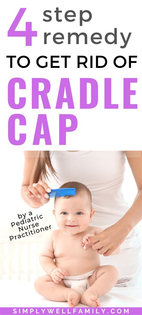 5 Tips for Cradle Cap Self-Care