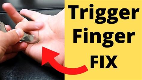 5 Tips to Fix Trigger Finger