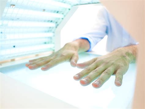 5 Ways Psoriasis Light Therapy Can Help