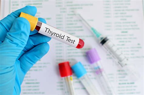 5 Ways to Utilize T3 Free Lab Test