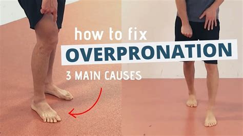 5 Ways to Fix Pronation