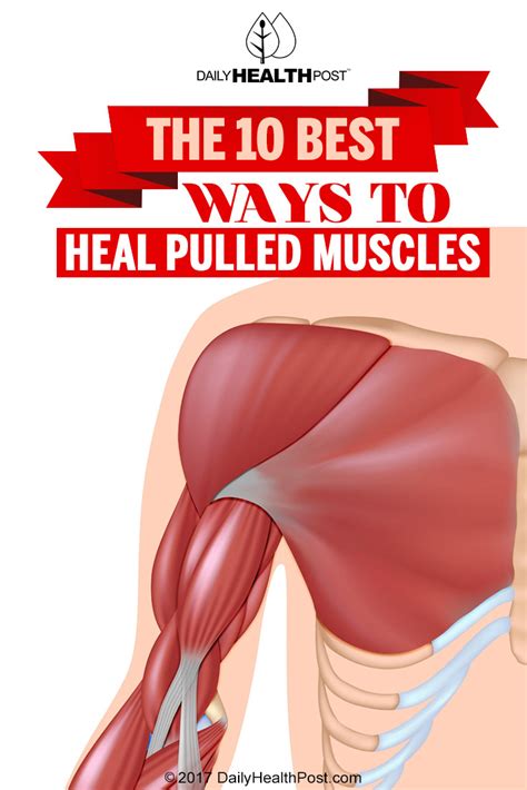 5 Ways to Heal Pulled Shoulder Muscle