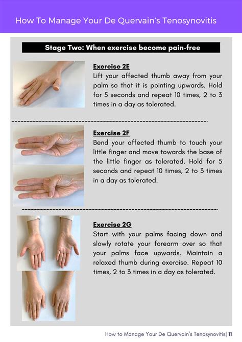 5 Ways to Manage De Quervain's Tenosynovitis