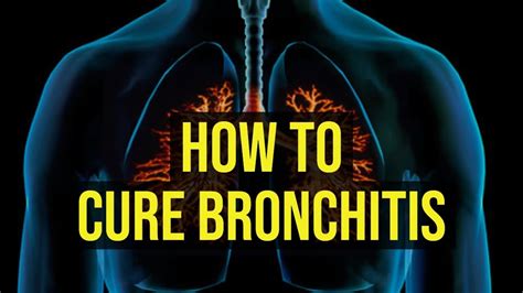 5 Ways to Treat Bronchitis