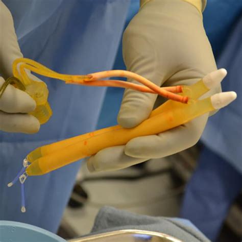 5 tips for penile implant surgery