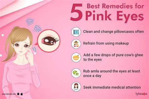 5 Ways to Treat Pink Eye