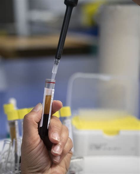5 K Blood Test Image