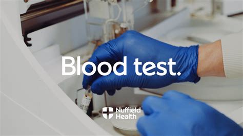 5 K Blood Test Procedure Image