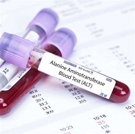 ALT Blood Test