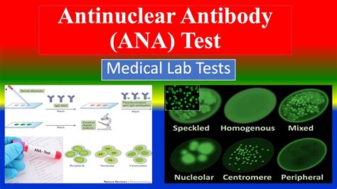 ANA Test Procedure