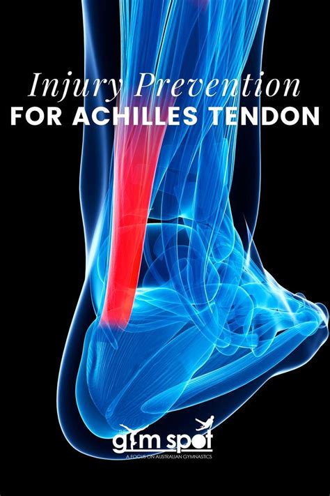Achilles Heel Tear Prevention
