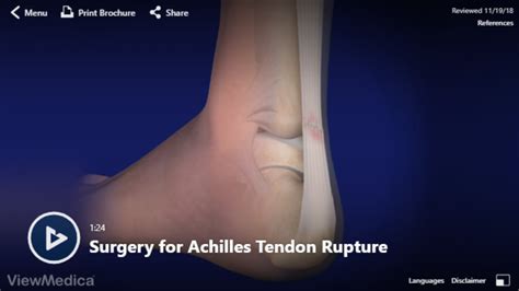 Achilles Tendon Repair Surgery