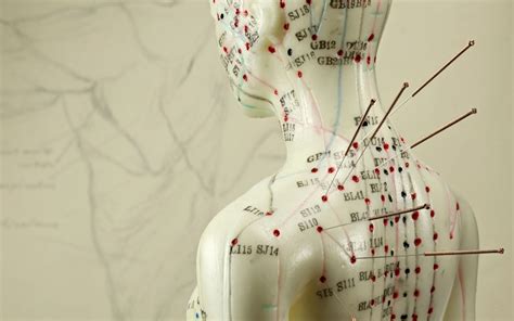 Acupuncture History