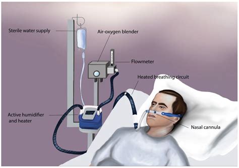 Administration of Oxygen Therapy