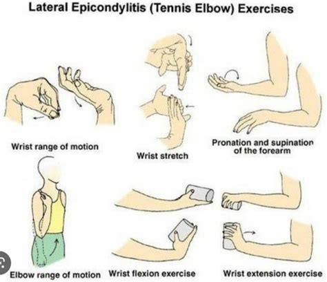 Advanced Therapies for Tennis Elbow