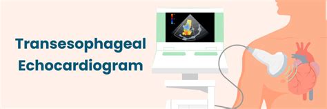 Advances in Transesophageal Echocardiogram Technology