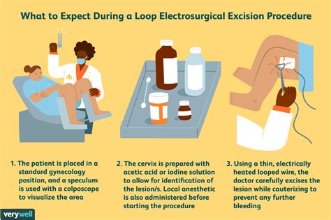 After the LEEP Procedure
