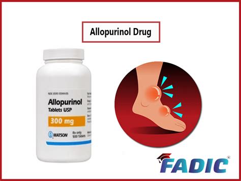 Allopurinol Management