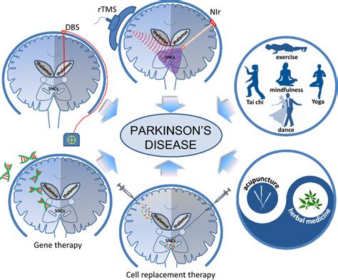 Alternative Therapies for Parkinson's Disease