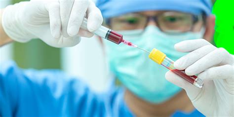 Ambulatory Acid Probe Test