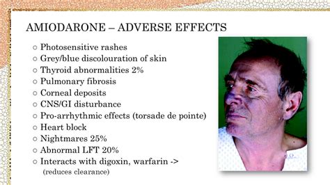 Potential Side Effects of Amiodarone