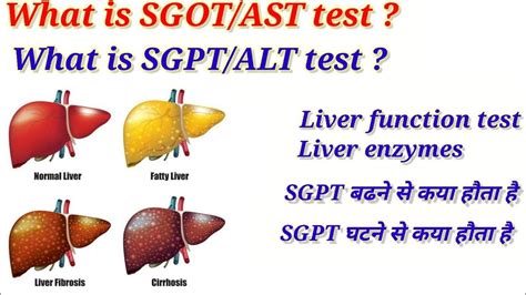 Applications of Alt SGPT