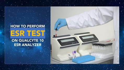 Applications of Automated Sedimentation Rate Testing