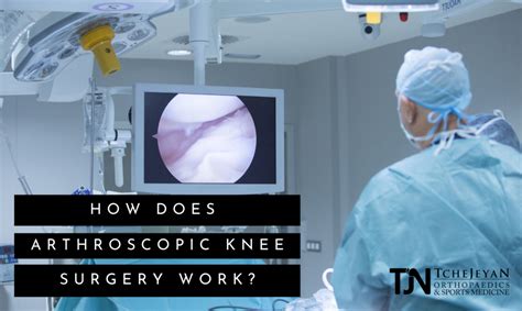 Arthroscopic Knee Surgery FAQs