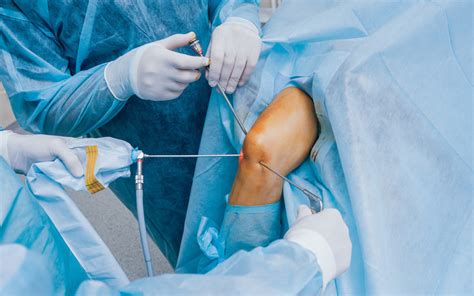 Arthroscopic Knee Surgery Procedure
