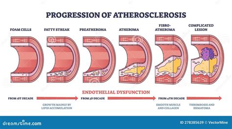 Atherosclerosis Introduction