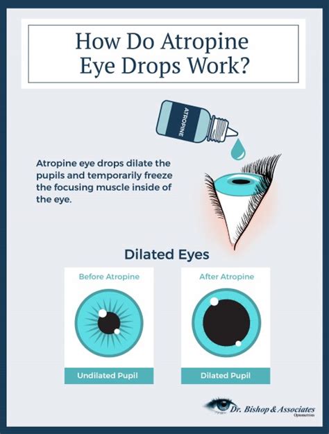 Atropine Eye Drops Administration