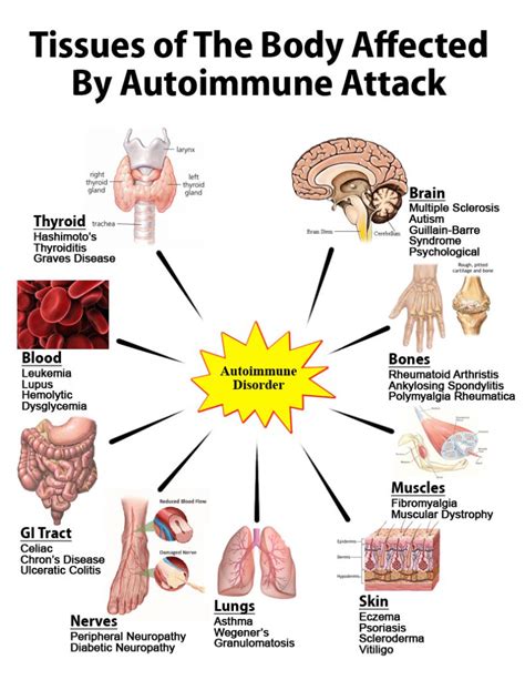 Autoimmune Disorders