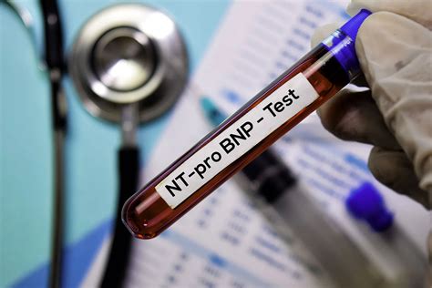 BNP Test Benefits
