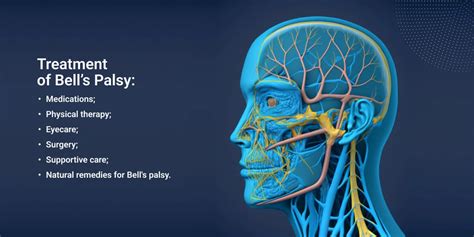 Bell Palsy Prevention