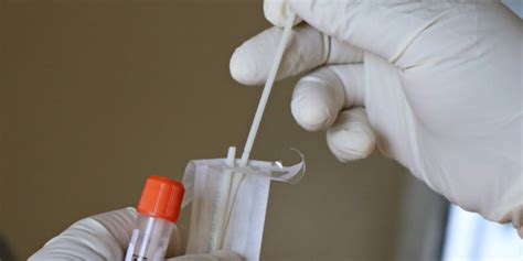 Benefits And Limitations Of Home DNA Test Kits