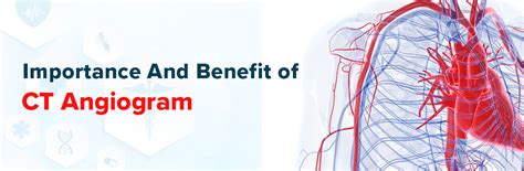 Benefits of Angio CT Scan Image