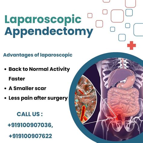 Benefits of Appendix Removal