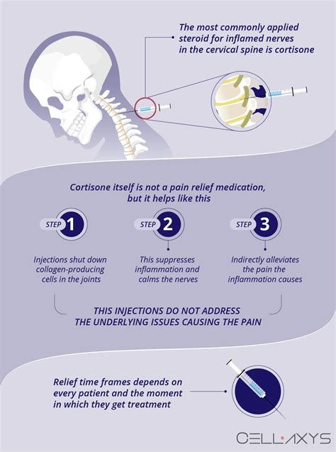 Benefits of Cervical Epidural Steroid Injections