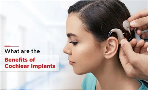 Benefits of Cochlear Implants