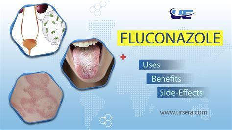 Benefits of Diflucan