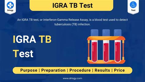 Benefits of Igra Tb Test