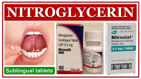 Benefits of Nitroglycerin Sublingual Tablets