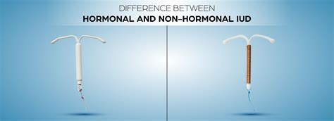 Benefits of Non-Hormonal IUDs
