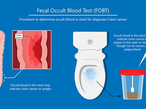 Benefits of Occult Blood Testing