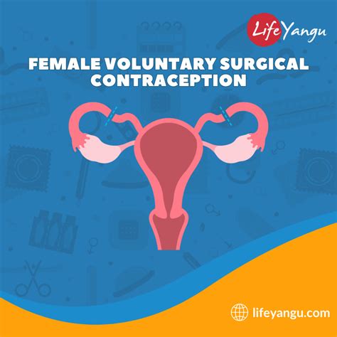 Benefits of Surgical Contraception
