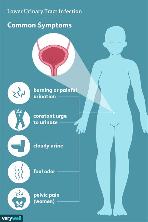 Bladder Infection Symptoms