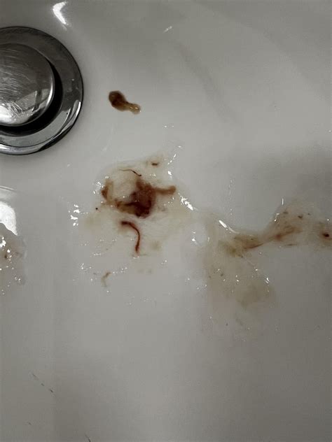 Blood in Phlegm