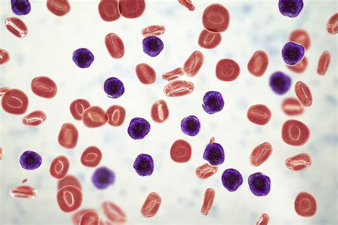 Blood Test Types For Blood Cancer Detection
