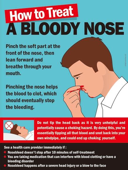 bloody nose next steps